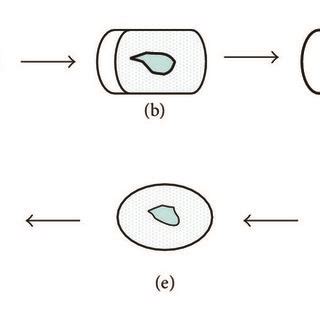 Schematic diagram illustration of the two phases in spheroplast ...