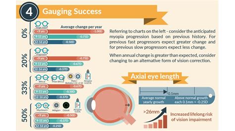 How To Gauge Success In Myopia Management | Myopia