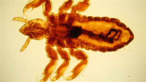 Body Louse - Explore Microscopy