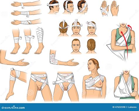 Bandaging techniques stock vector. Illustration of injury - 47632598