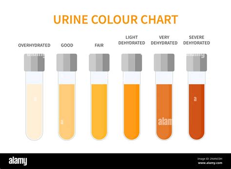 Urine color chart illustration of dehydration level Stock Vector Image ...