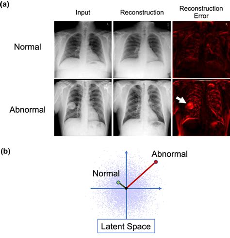 Overview of our anomaly detection system. (a) Anomaly detection based ...