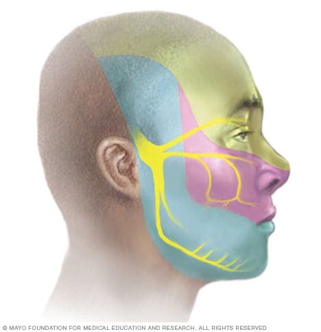 Trigeminal Neuralgia Signs And Symptoms