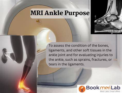 MRI Ankle: Price, Purpose, Procedure & Results [2025] • Bookmerilab