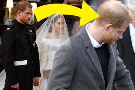 Prince Harry hair loss ? Is Prince Harry wearing hair loss CONCEALER ...