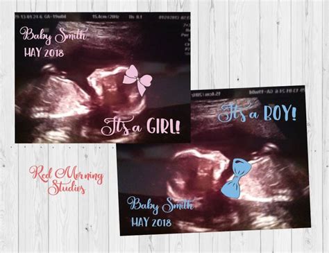 Ultrasound Gender Reveal. DIGITAL FILE. Sonogram Gender Announcement ...