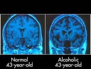 Alcohol: Effects on Neurobehavioral Functions and the Brain | Ballard ...