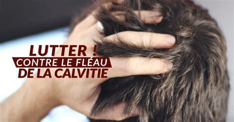 Lutter contre calvitie - Barbichette.fr