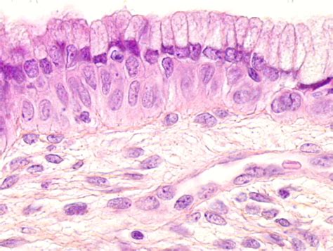 Endocervix Histology