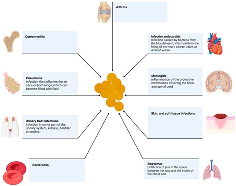 Staphylococcus Aureus Infection Treatment