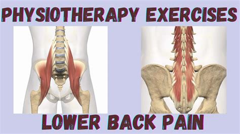 Physiotherapy Exercises for Lower Back Pain