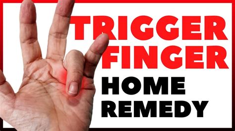 TRIGGER FINGER HOME REMEDY | PHYSICAL THERAPY SESSION - YouTube