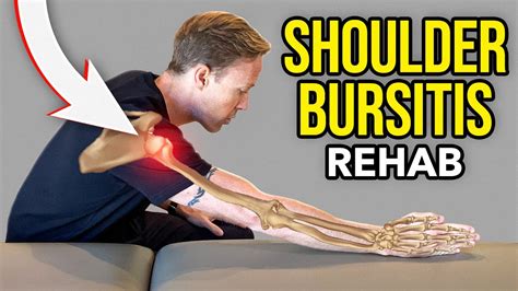 Subdeltoid Bursitis Exercises | Hot Sex Picture