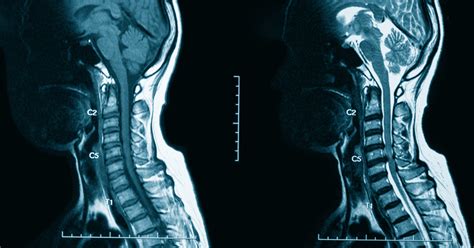 CT With Contrast and MRI With Contrast: Facts to Know • Touchstone ...