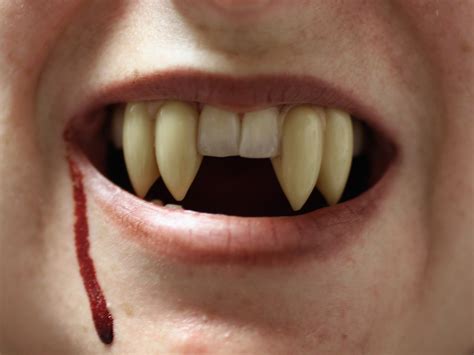 How To Get Vampire Teeth For Real - Bloodlust FX Fangs | MostlyDead.com ...