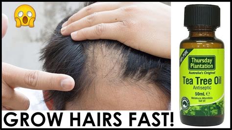 Tea Tree Oil For Hair Before And After - 7 Amazing Benefits Uses Of Tea ...