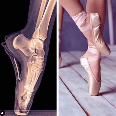 DANCERS & YOUR FEET - Springfield Physical Therapy & Wellness