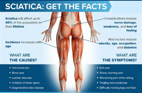 Sciatica: “Why Does My Back Problem Cause Such Severe Leg Pain?"