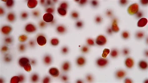 Haematococcus Images – Browse 125 Stock Photos, Vectors, and Video ...