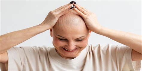 Frontal Fibrosing Alopecia: Symptoms, Causes & Treatment