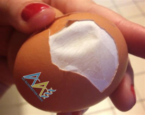 Natural Eggshell Membrane (NEM) - Rebuild Cartilage | AAI Clinic