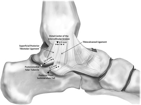 The ligament anatomy of the deltoid complex of the ankle: a qualitative ...