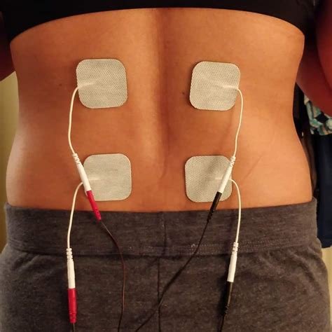 Tens Unit Placement Diagram