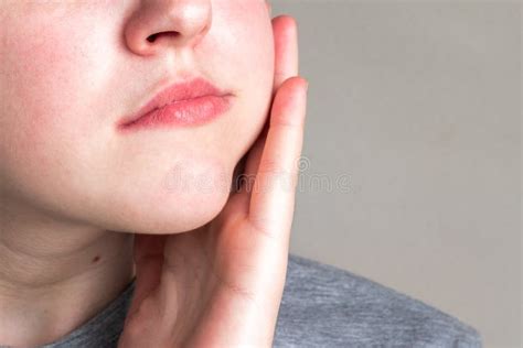 CHEEK SWOLLEN : CAUSES , SYMPTOMS , TREATMENTS