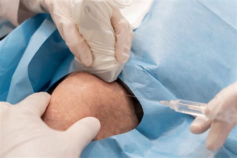 Prepatellar bursitis aspiration & cortisone injection | Musculoskeletal ...