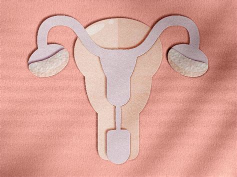 Ovarian teratoma: Symptoms, causes, and more