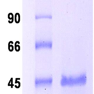 SDS-PAGE gel analysis of size-exclusion chromatography purified ...