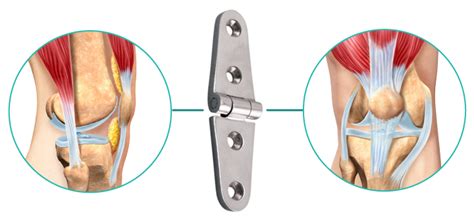 Hinge Joint Knee Diagram