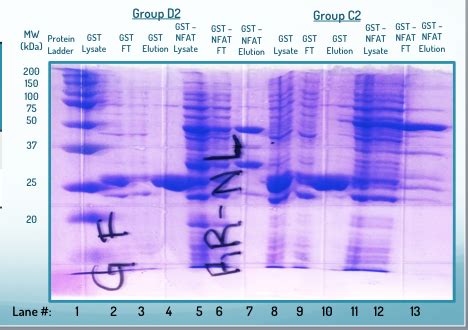 lab techniques - Help analyzing SDS-Page gel - Biology Stack Exchange