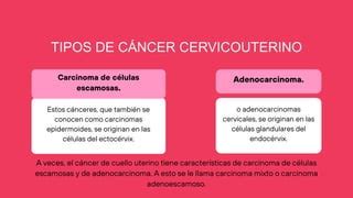 RESUMEN SOBRE CÁNCER CERVICOUTERINO.pptx | Descarga Gratuita