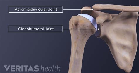 Acromioclavicular Osteoarthritis Diagnosis