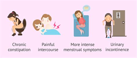 Retroverted Uterus Exercises