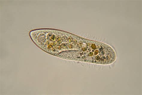 Examples Of Protists For Kids