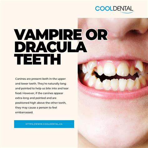 Vampire or Dracula Teeth