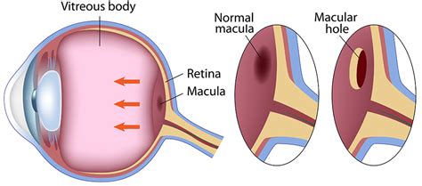 Normal Macula