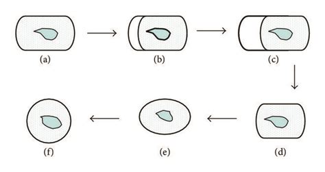 Schematic diagram illustration of the two phases in spheroplast ...