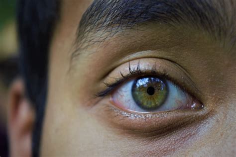 Hazel Eyes: Advantages, Disadvantages & More | MyVision.org