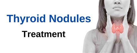 Thyroid Nodule Treatment Without Surgery - Maven Medical Center