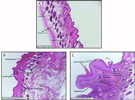 H&E stained cross-sections of mouse skin: (A) normal mouse skin (NC ...