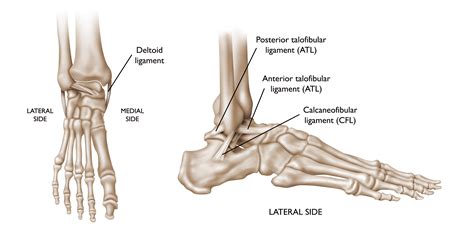 Sprained Ankle - OrthoInfo - AAOS