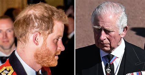 Prince Harry's Hair Loss Isn't Due To Stress, Expert Blames Prince Charles