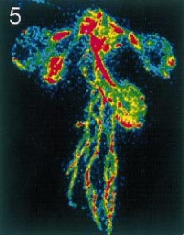 Calcium dynamics in intact plants expressing aequorin can be imaged ...