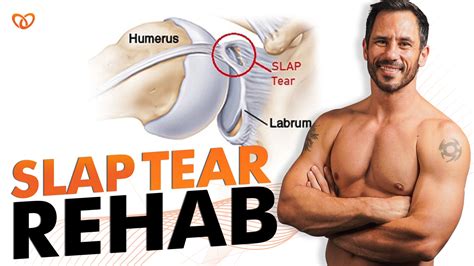 From Pain to Gain: Unlock the Secrets to Rapid SLAP Tear Recovery ...