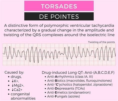 NTENL edℹℹne on Twitter Torsades de Pointes a distinct