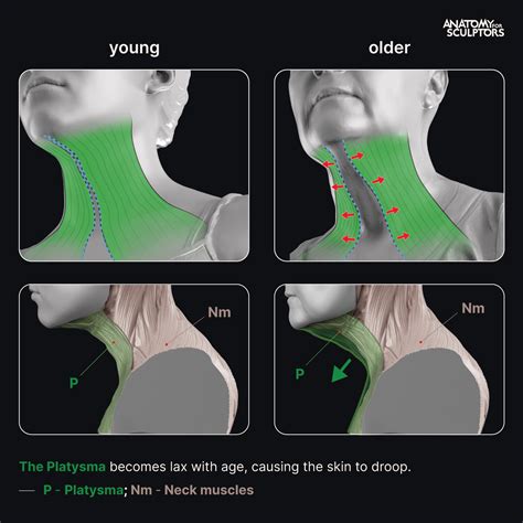 Anatomy For Sculptors - What causes turkey neck?