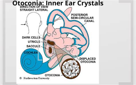 Otoconia: Inner Ear Crystals by Leigh Baney on Prezi